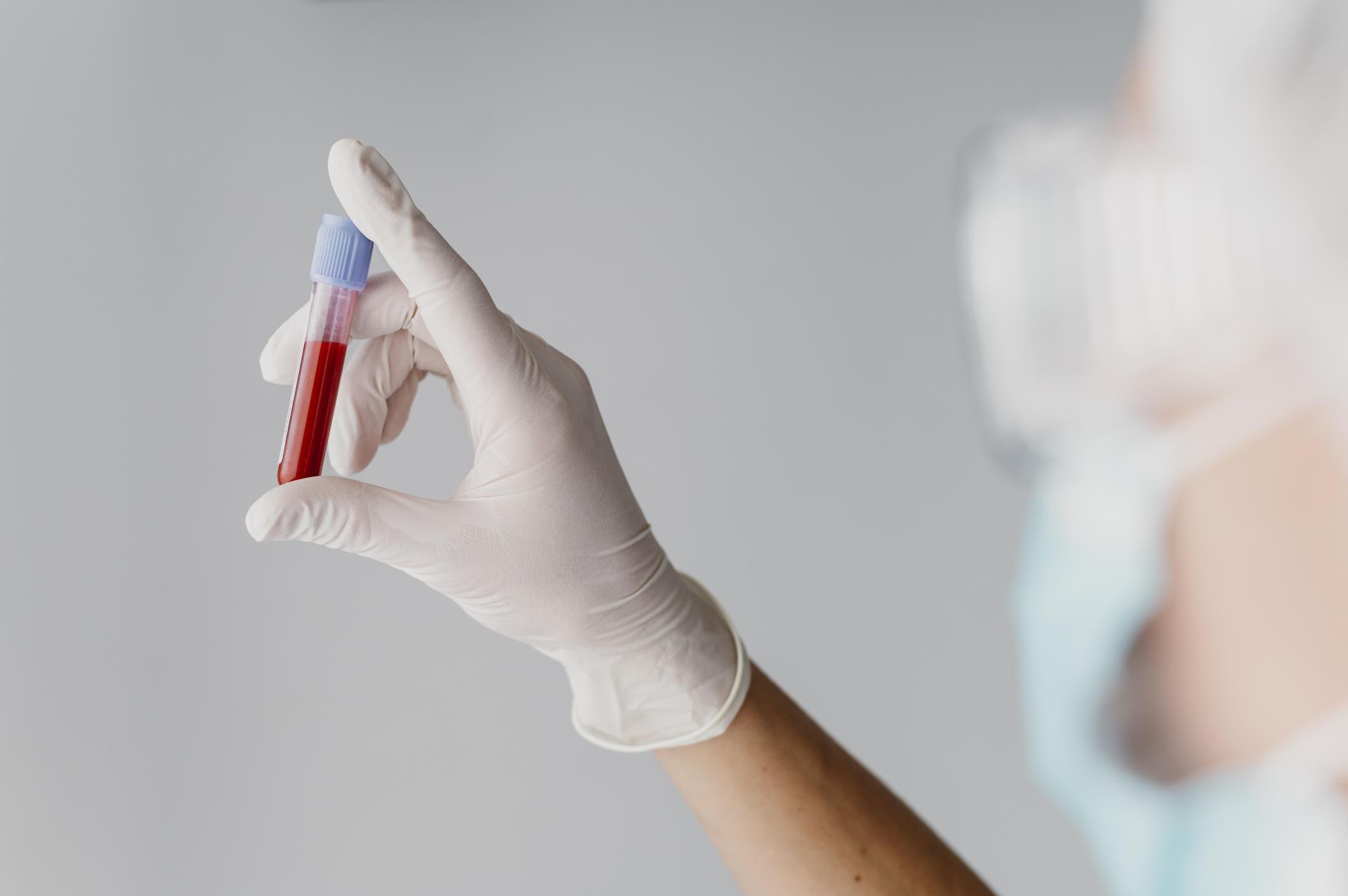 back-view-doctor-holding-blood-sample