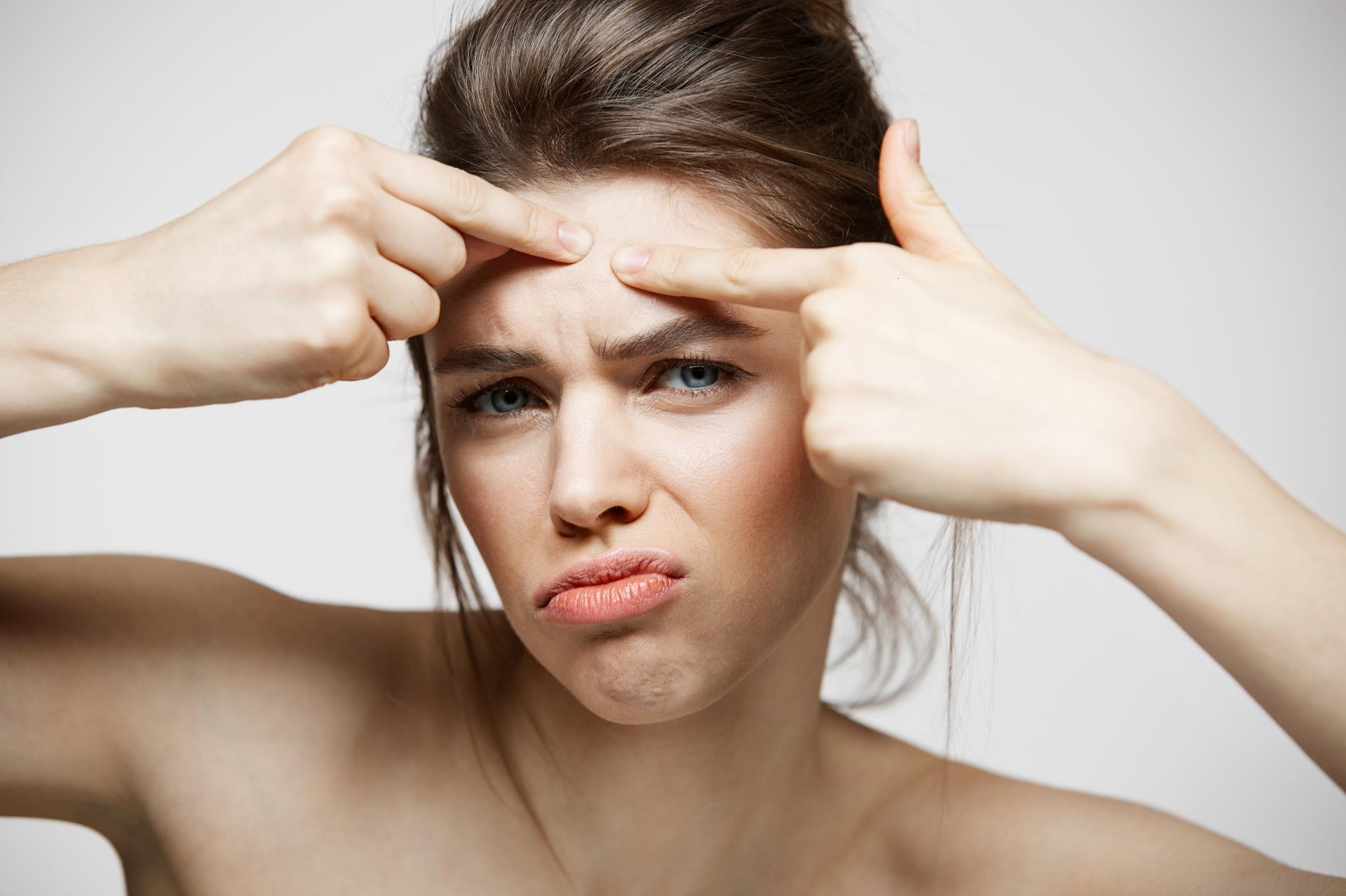 young-brunette-girl-displeased-her-problem-acne-face-skin-white-background-health-cosmetology-skincare